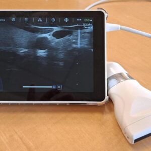 echographe-super-portable-sonoscanner-u-lite-pro-avec-3-sondes-interchangeables-convexe-lineaire-cardiaque