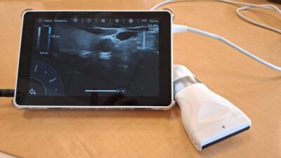 Echographe super portable sonoscanner u-lite pro avec 3 sondes interchangeables : convexe, lineaire, cardiaque