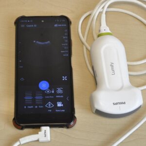 sonde-convexe-lumify-c5-2