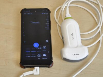 Sonde convexe lumify c5-2