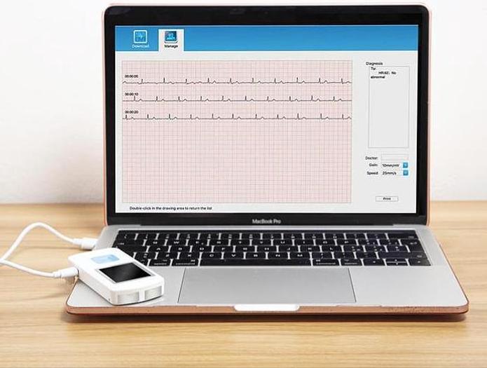 ECG de poche PM10 – Image 3